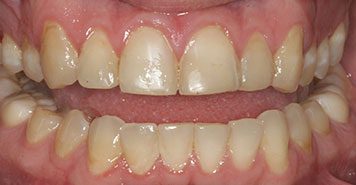 Family, Cosmetic & Implant Dentist in Lexington, KY