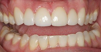 Family, Cosmetic & Implant Dentist in Lexington, KY