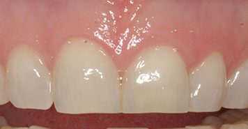 Family, Cosmetic & Implant Dentist in Lexington, KY