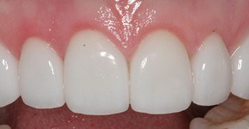 Family, Cosmetic & Implant Dentist in Lexington, KY