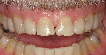 Family, Cosmetic & Implant Dentist in Lexington, KY