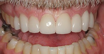 Family, Cosmetic & Implant Dentist in Lexington, KY