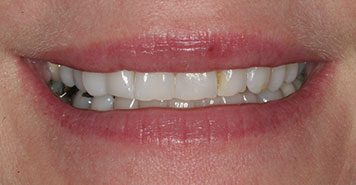 Family, Cosmetic & Implant Dentist in Lexington, KY
