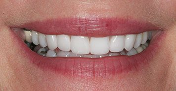 Family, Cosmetic & Implant Dentist in Lexington, KY