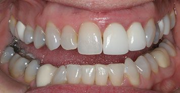 Family, Cosmetic & Implant Dentist in Lexington, KY