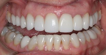 Family, Cosmetic & Implant Dentist in Lexington, KY