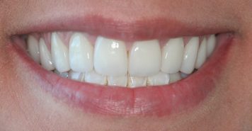 Family, Cosmetic & Implant Dentist in Lexington, KY