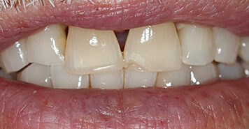 Family, Cosmetic & Implant Dentist in Lexington, KY