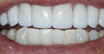 Family, Cosmetic & Implant Dentist in Lexington, KY
