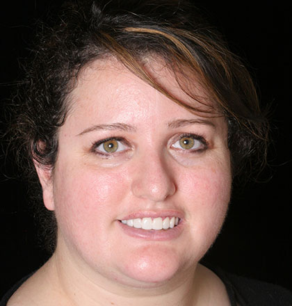 Patient 38portrait