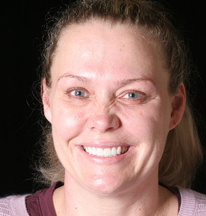 Patient 42portrait
