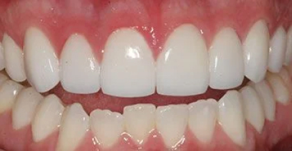 Lexington Kentucky Cosmetic Dentist | Hamburg Expressions | Dr Jenny Miller DMD