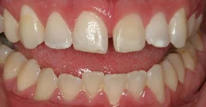 Lexington Kentucky Cosmetic Dentist | Hamburg Expressions | Dr Jenny Miller DMD