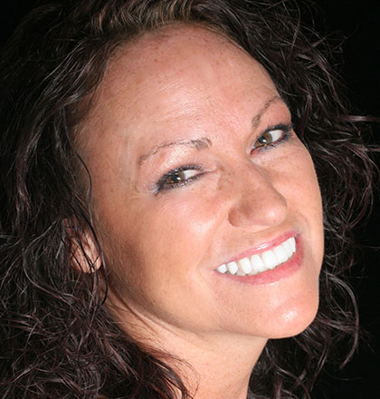 Dental Implants In Lexington Kentucky